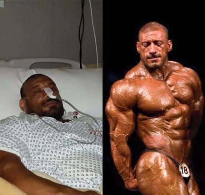 risks of anabolic steroids